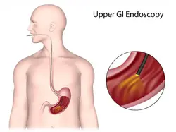 Endoscopy