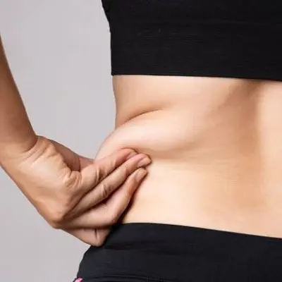 What Doctors Look For Before Approving Liposuction