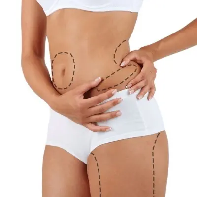 Quick Guide: Laser Liposuction for Men and Women