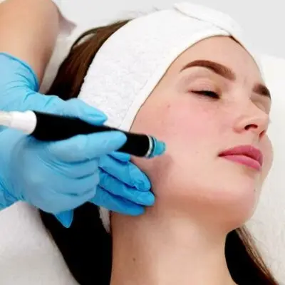 Ameson Treatment vs. Chemical Peels: Which Is Safer?
