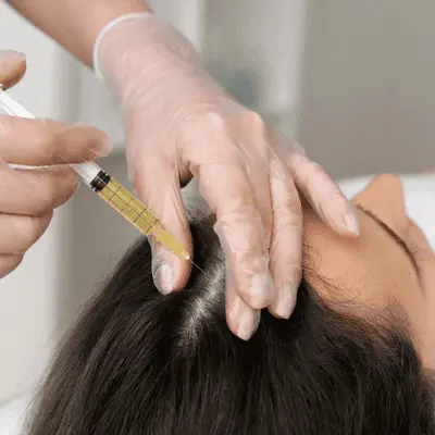 PRP Hair Treatment Tips for Maximizing Hair Regrowth