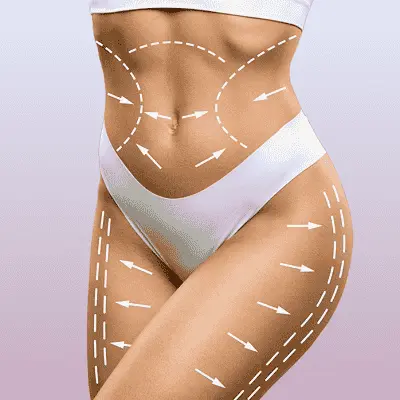 Body Fillers for Back Dimples: What’s Possible