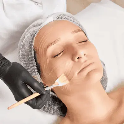 Can a TCA Peel Help with Stretch Marks?