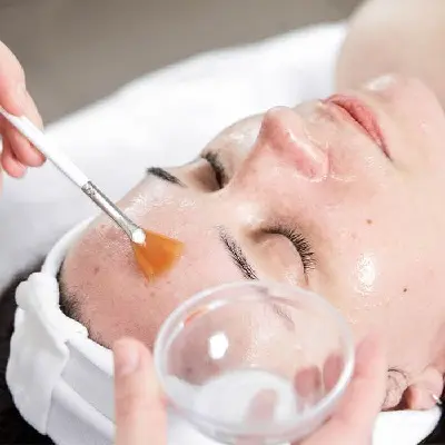 TCA Peel for Uneven Tone: What to Know