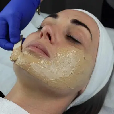 Dermamelan Treatment: Step-by-Step Process Explained