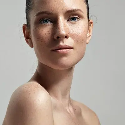Dermamelan Treatment Healing Process Explained Simply