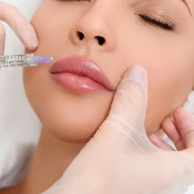 What Happens During Lip Fillers Injections Step by Step