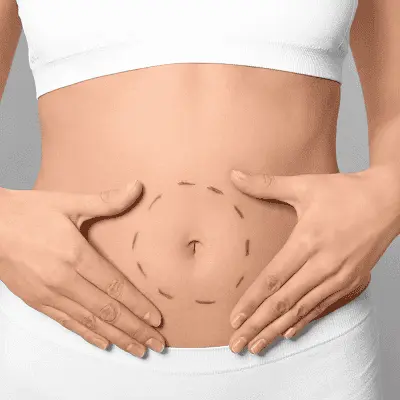 10 Things to Know Before a Tummy Tuck