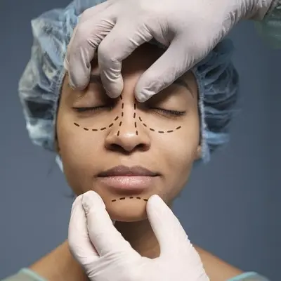 Rhinoplasty Surgery Swelling: How Long Does It Last?