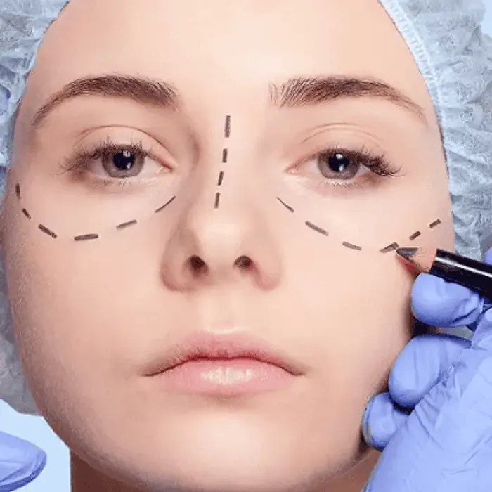 What Is Cosmetic Surgery and How Does It Work?