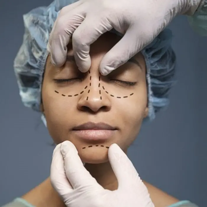 Rhinoplasty Surgery Results: How Natural Can Outcomes Look?