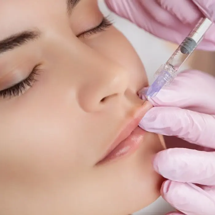 Where Are Dermal Fillers Injections Most Commonly Used?