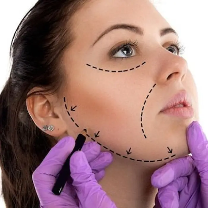 Can Cosmetic Surgery Be Reversed? What to Know