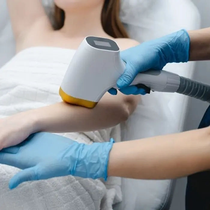 Laser Hair Removal: Complete Beginner's Guide for 2026