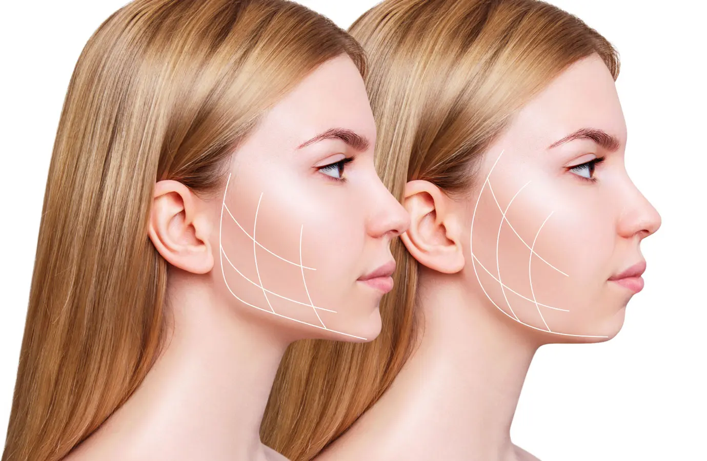 How Can Double Chin Removal Perfectly Sculpt Your Lower Face