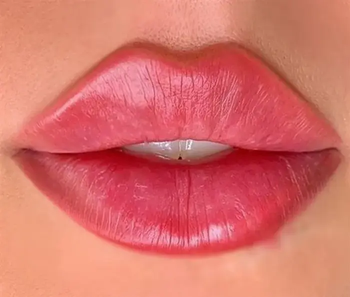 Can Russian Lip Filler create youthful plump lip revival effect?
