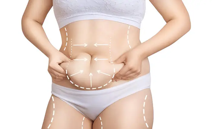 Can Liposuction Bring a New Era of Body Shaping Perfection?