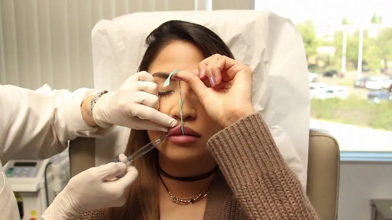 How Do Lip Fillers Improve Lip Volume Naturally Today?
