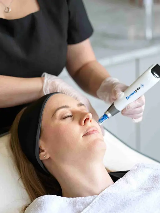How Does Dermapen Microneedling Improve Skin Texture?