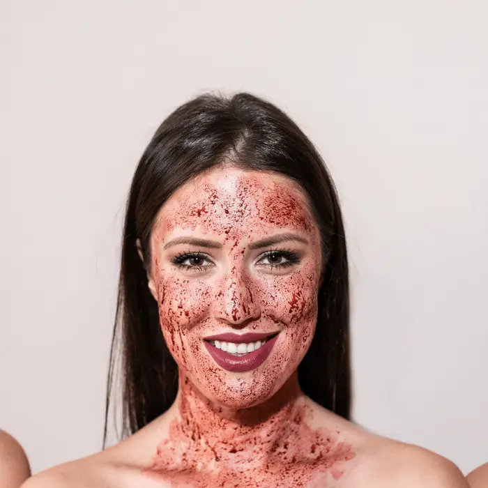 Is Vampire Facial Worth It for Skin Rejuvenation?