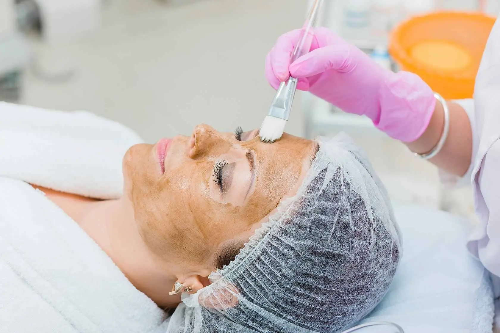 How Can Cosmelan Peel Treat Sun Damage Skin?