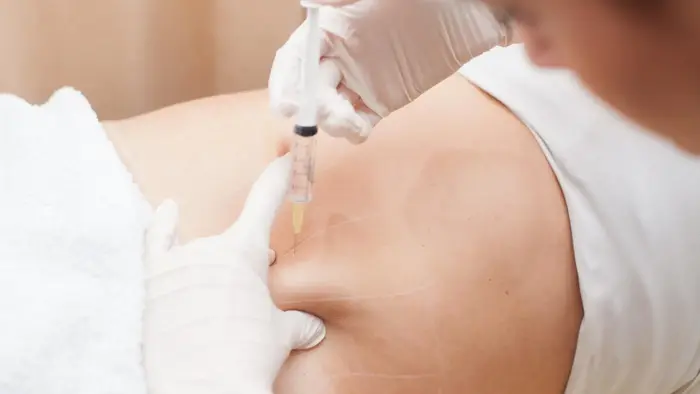 How Does Aqualyx Injection Work on Localized Fat?