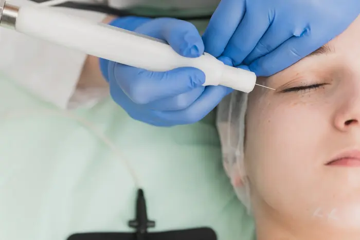Is Plasma Pen Treatment Good for Skin Firming?