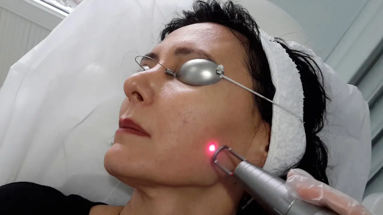 Why Does Pico Laser Treatment Deliver Faster Pigment Correction Results?