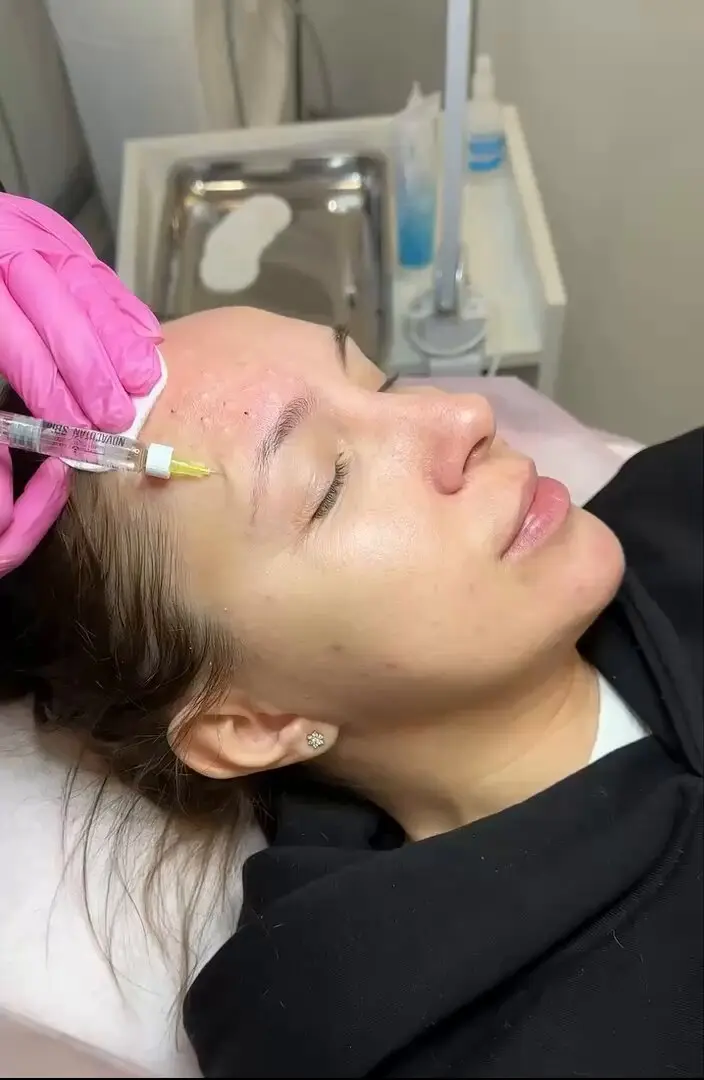 How Does a Non Surgical Brow Lift Lift Drooping Brows?