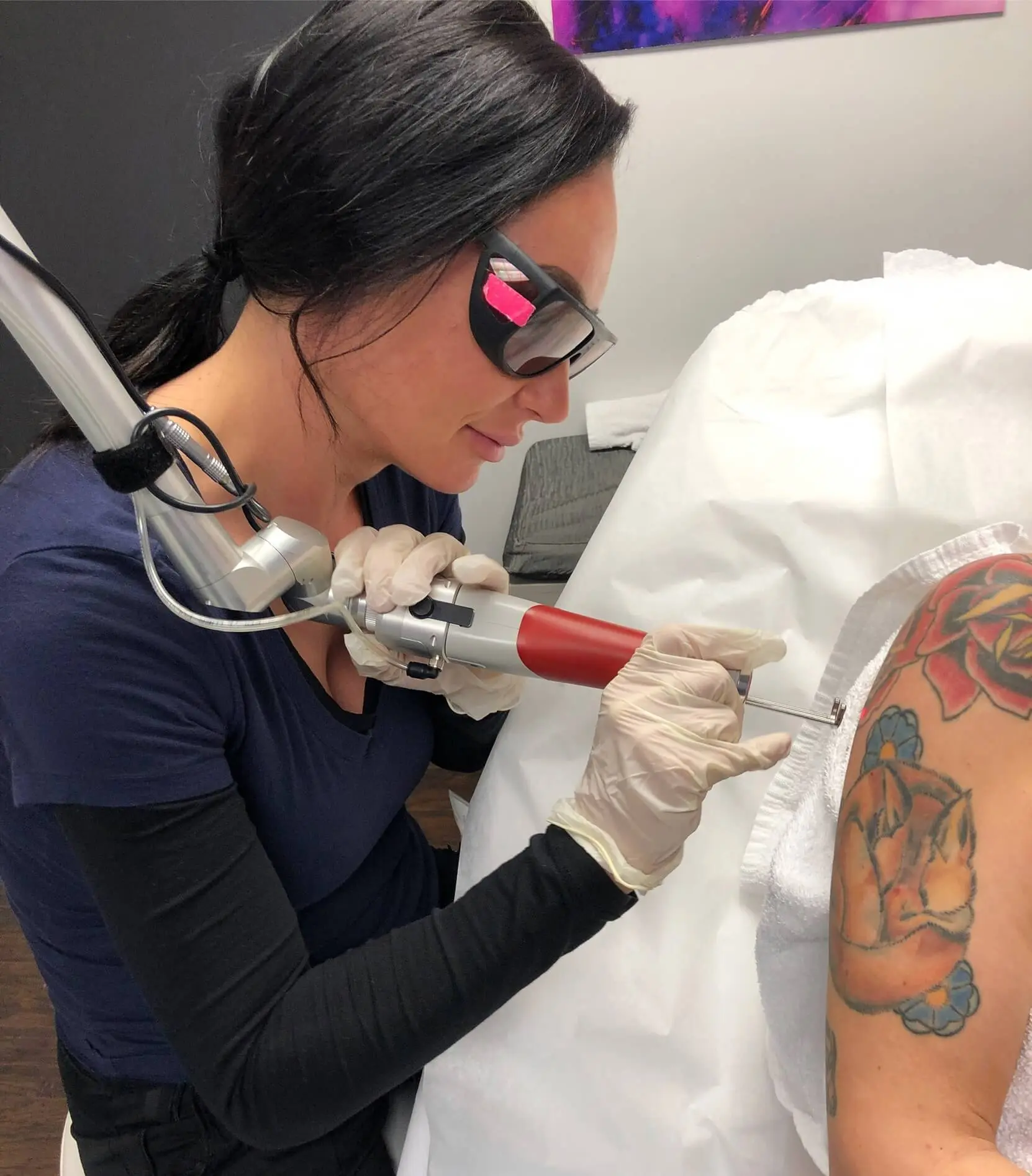 Can Laser Tattoo Removal Work on Tattoos With Thick Ink Layers?