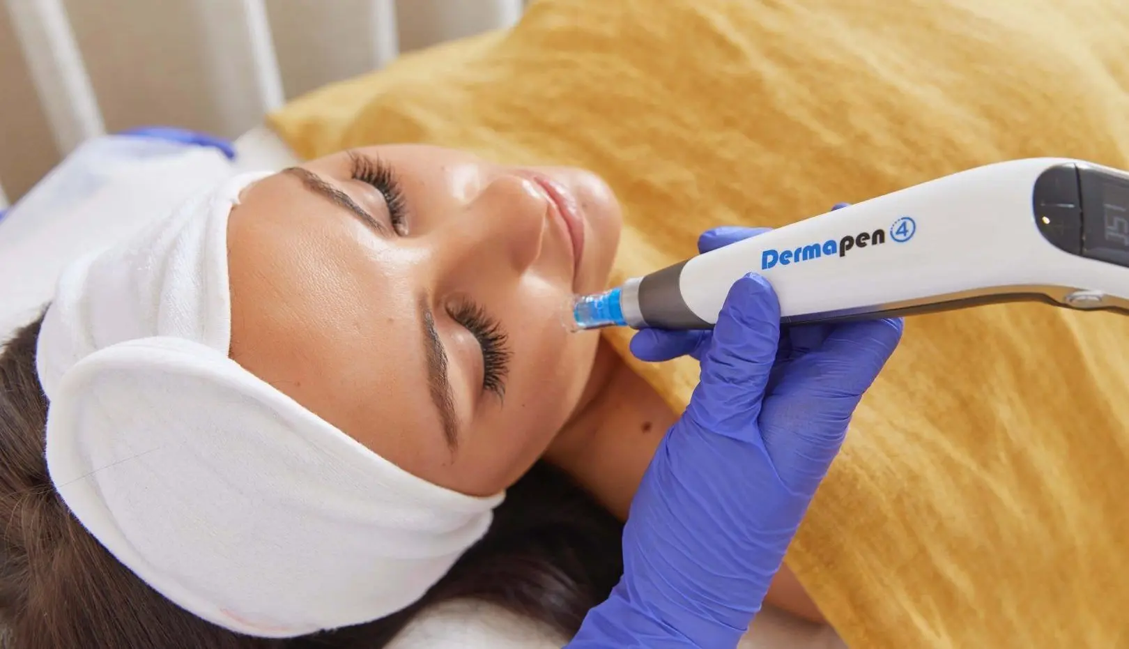 What Happens During Dermapen Microneedling Treatment?