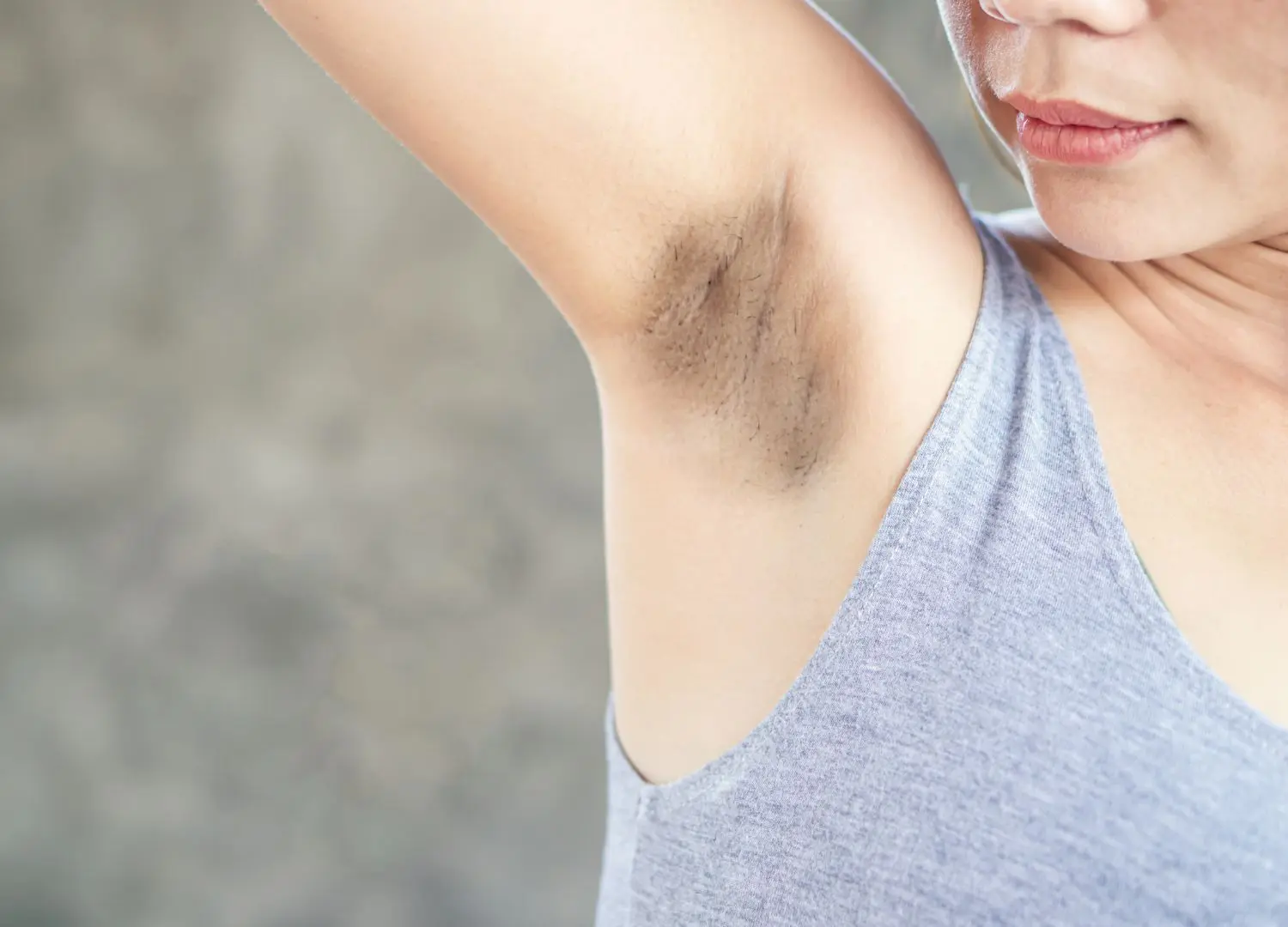 How Does a Chemical Peel for Dark Underarms Work?