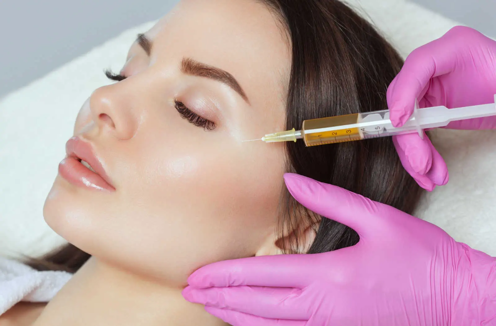 Can PRP Fillers Help Reduce Acne Scars?