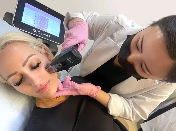 How Does Morpheus8 Skin Tightening Improve Firmness?