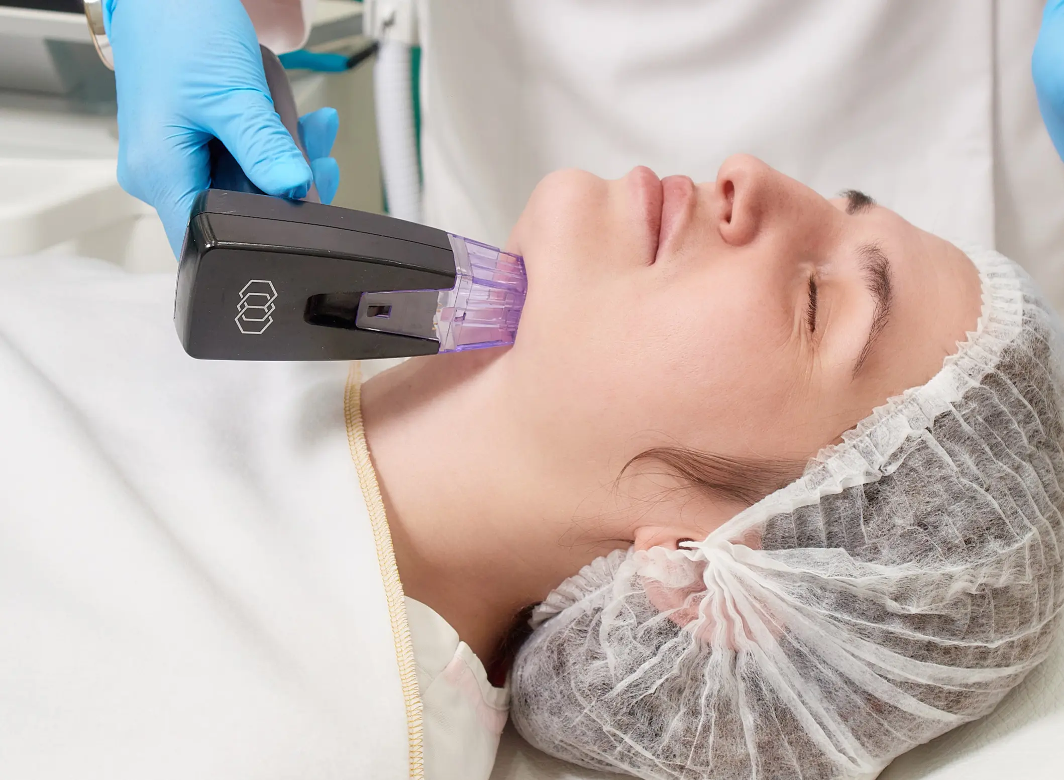 Can Morpheus8 Treatment Refresh Dull Aging Skin?