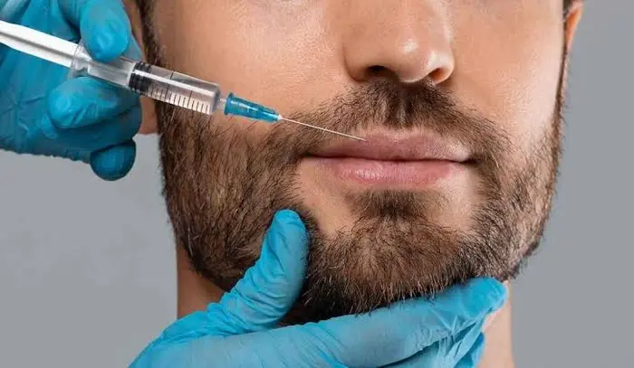 Can Men Get Lip Filler Injections?