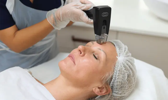 How does Morpheus8 improve skin elasticity?