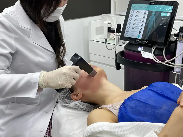 What Should You Expect After Morpheus8 Treatment?