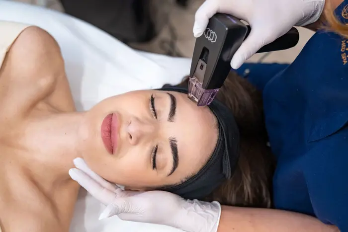How Does Morpheus Treatment Tighten Skin Naturally?