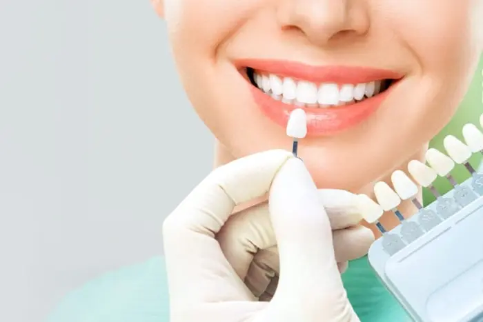 How Do Dental Veneers Help with Gaps Between Teeth?