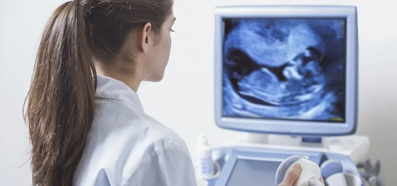 Ultrasound Monitoring 