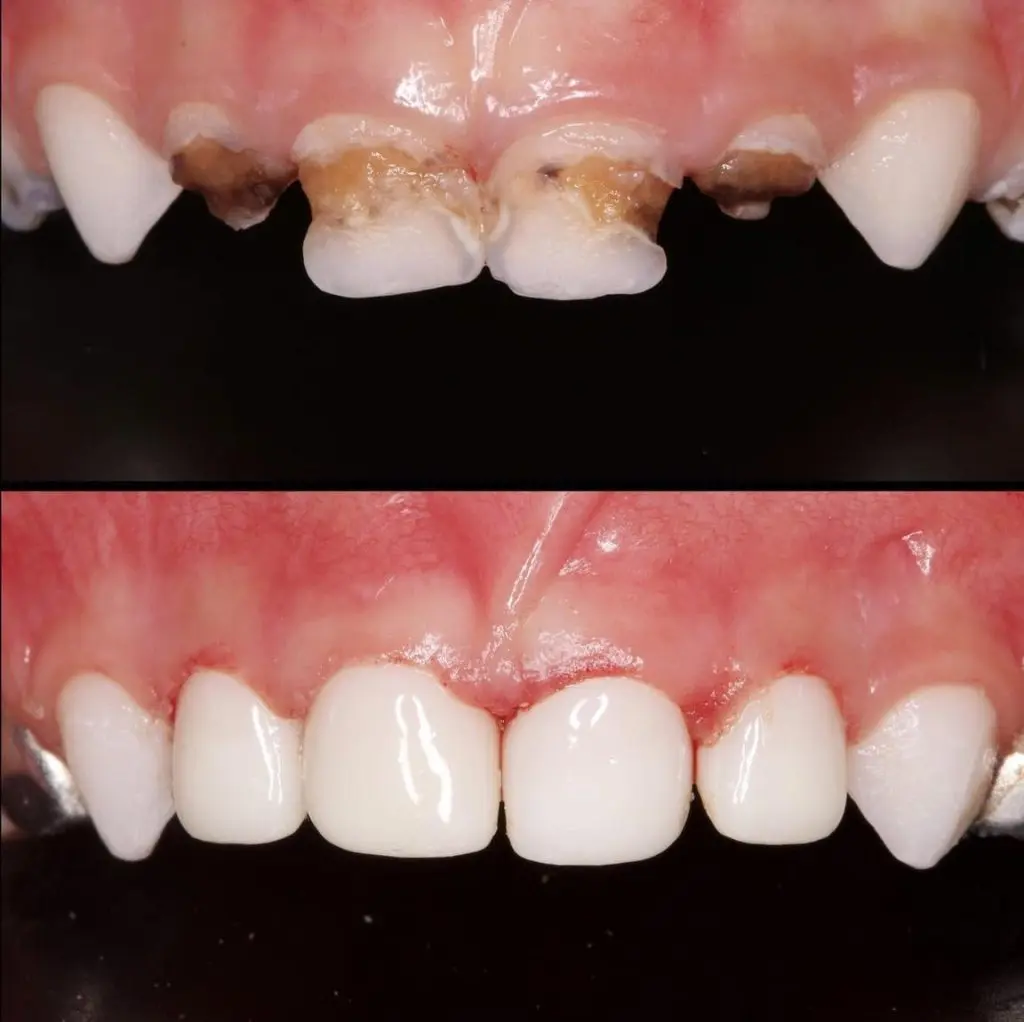 Kids Dentistry