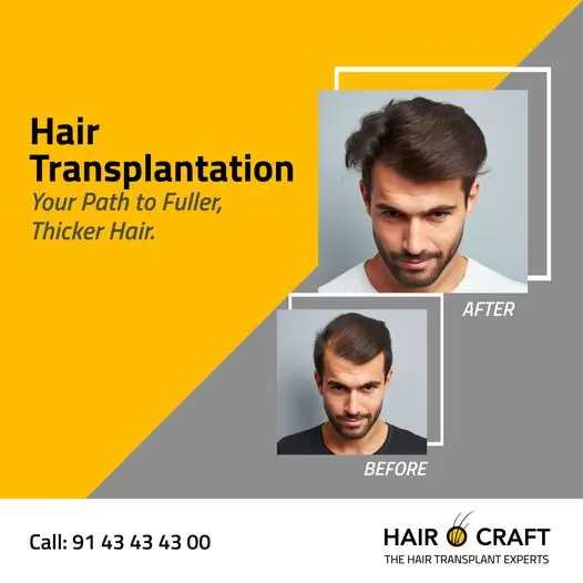Hair Transplant