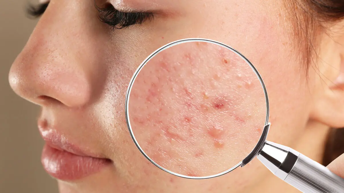 General Dermatology