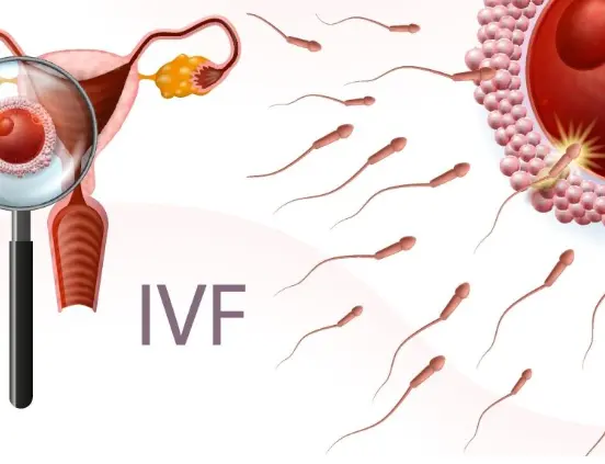 In Vitro Fertilization (IVF)