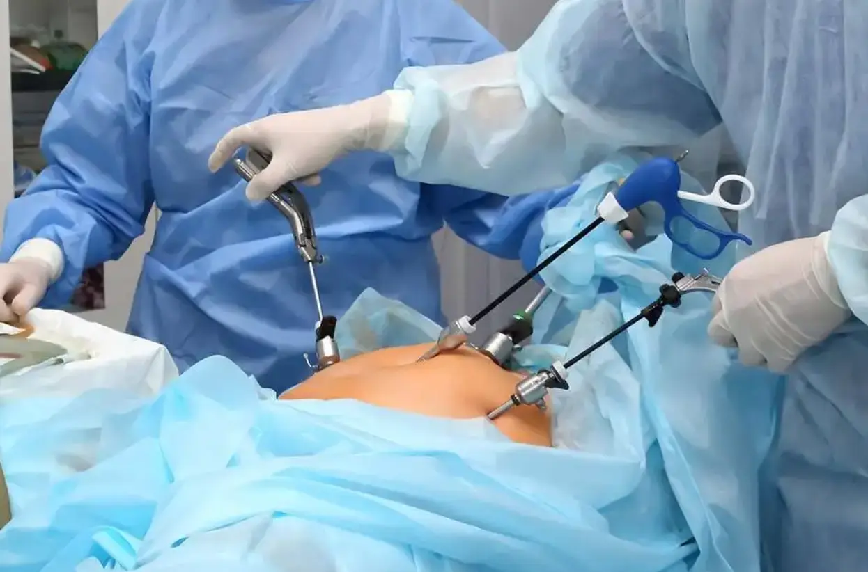 Laparoscopic Myomectomy