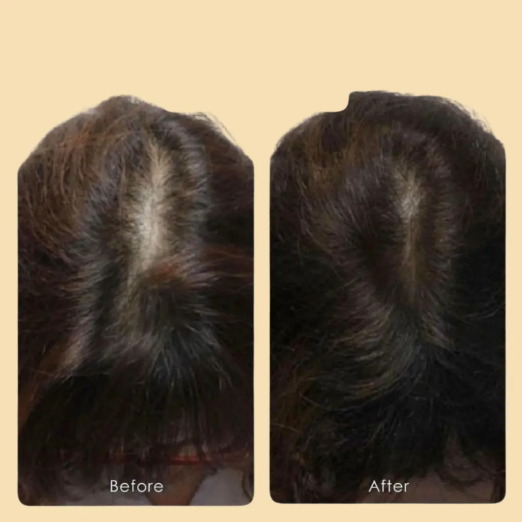 Hair Treatments