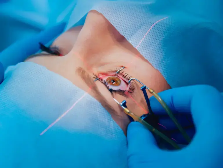 Lasik Treatment