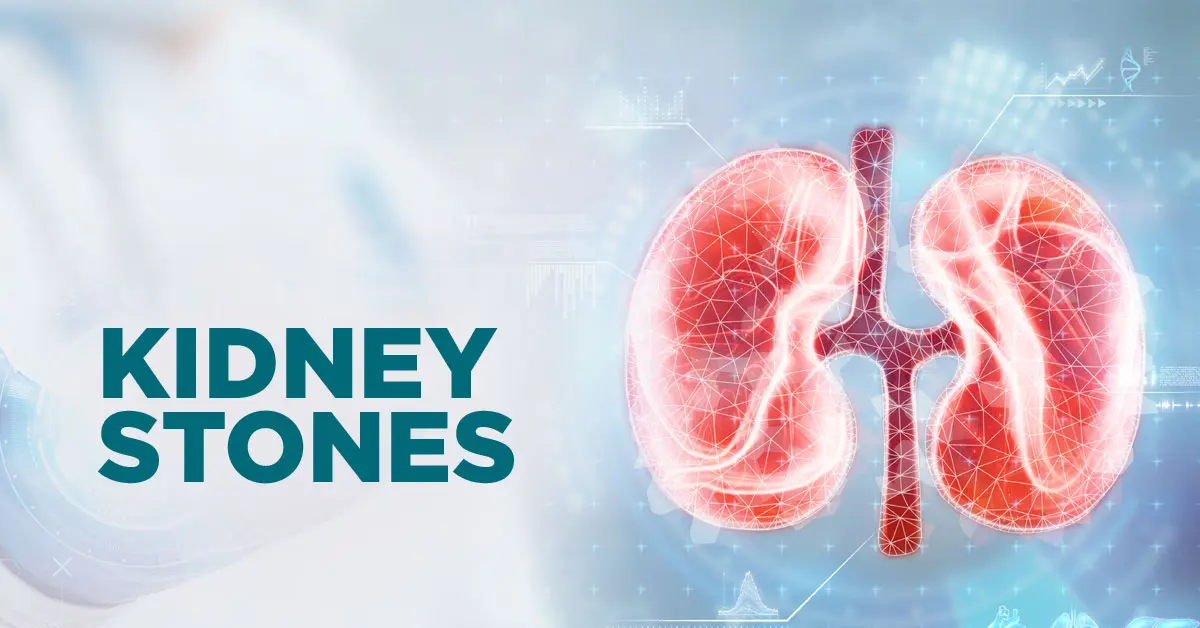 Kidney Stones