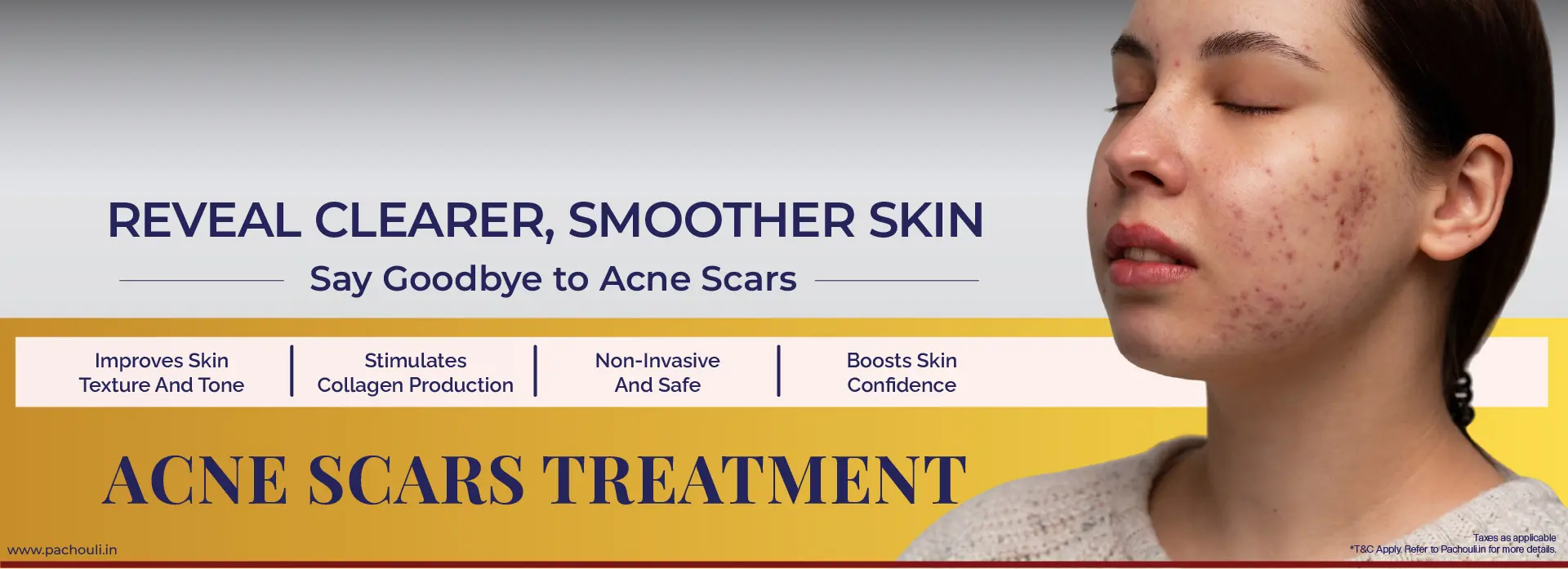 Acne Scar Treatment In Delhi